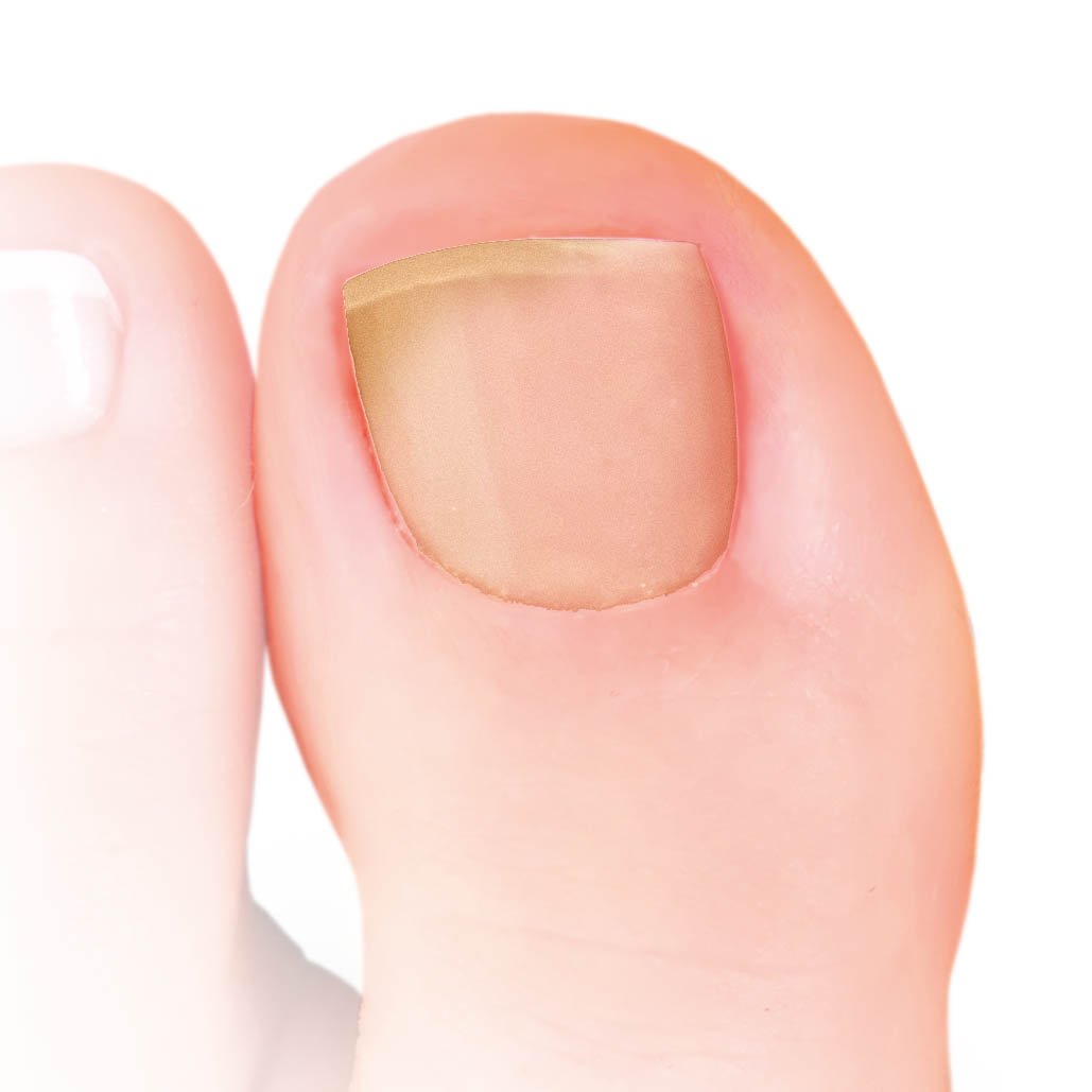 Nailner-toe-box-discoloration