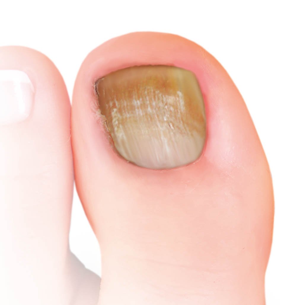 Nailner-toe-box-thick