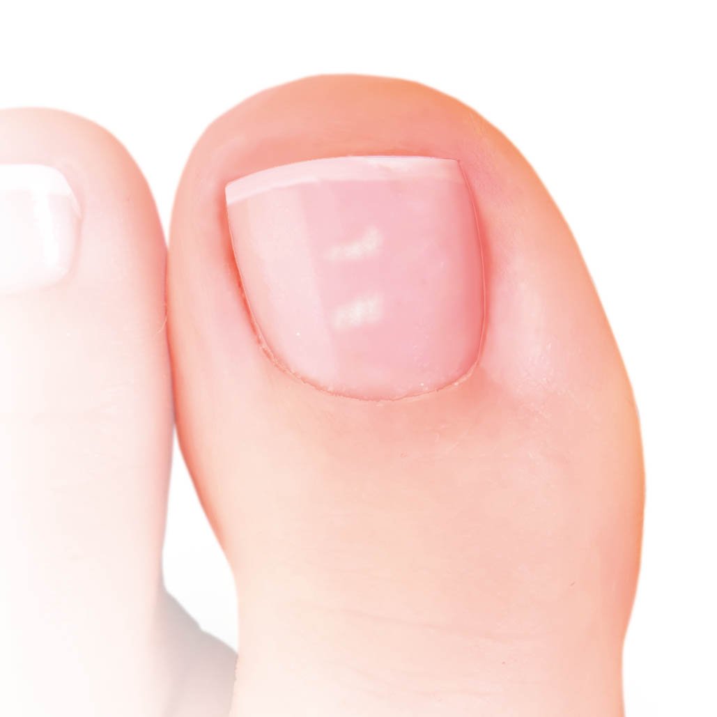 Nailner-toe-box-whitespots